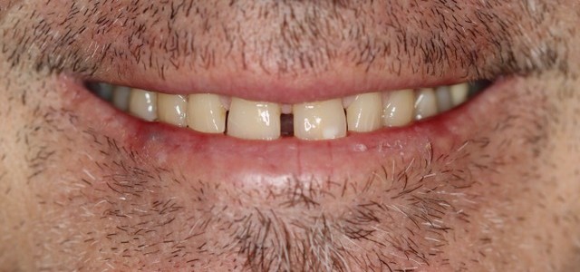 9D01-before